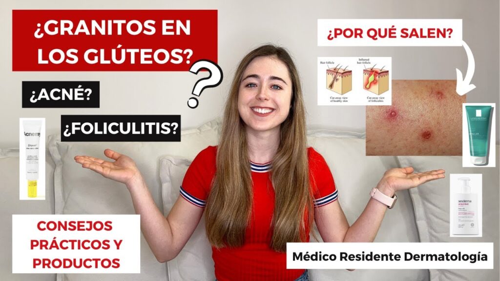 Cómo quitar las manchas de granos en los glúteos